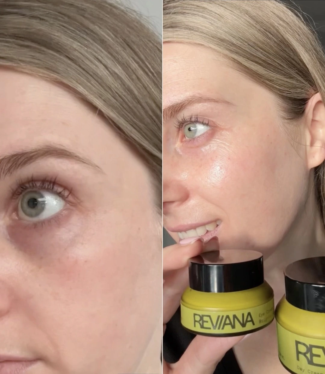 The existing before-and-after comparison from the current Eye Cream page