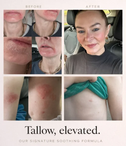 Before and After